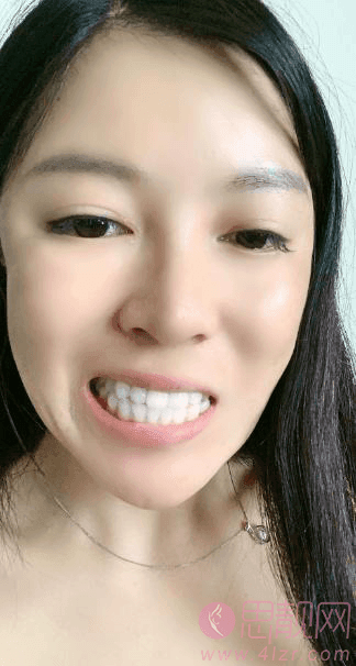 西安画美团圆口腔医院怎么样？含牙齿种植+2021年价格表一览