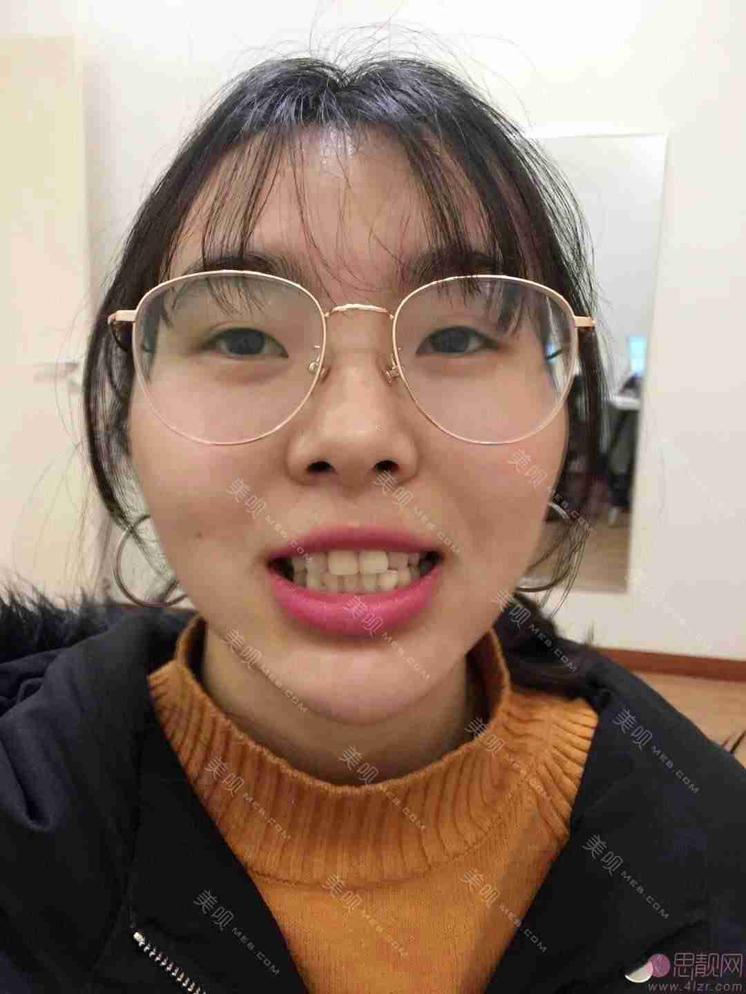 上海摩尔星松口腔医院怎么样？2021收费曝光+牙齿美白案例分享