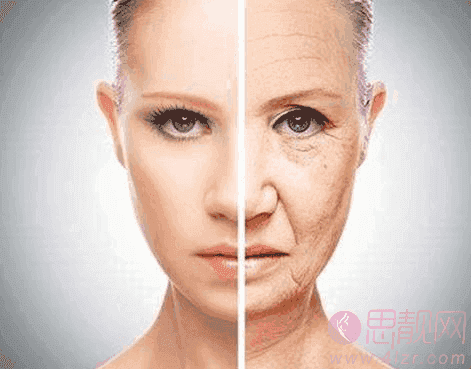 面部衰老怎么解决 面部年轻化的较好方法