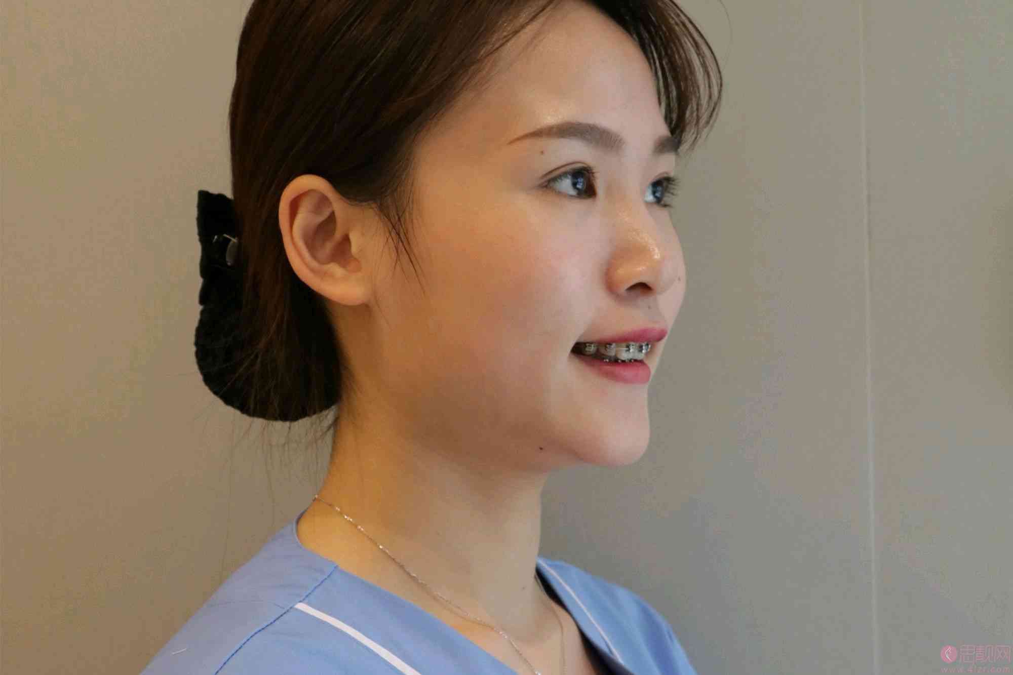 广州广大口腔门诊部怎么样？牙齿矫正案例分享、2021价格表一览