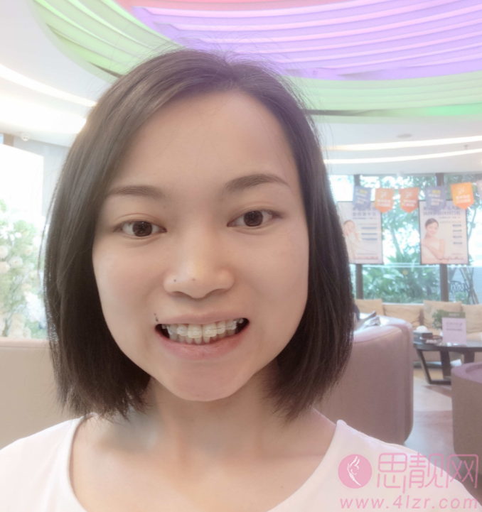 上海赛德口腔门诊部价格表公开+牙齿矫正前后果对比