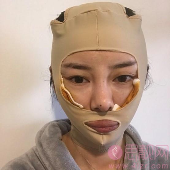 北京八大处杨斌颅颌面畸形修复做的怎么样？