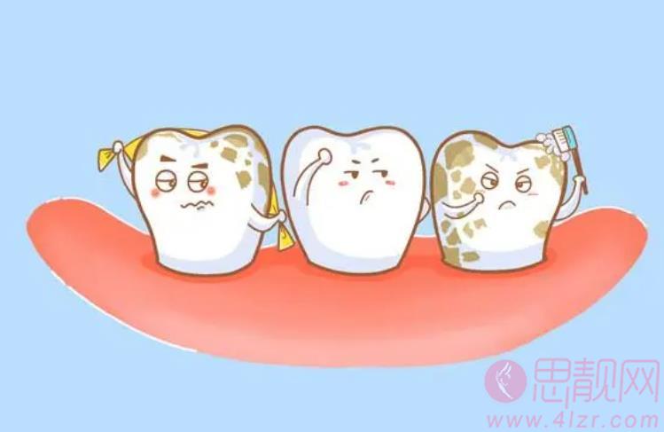 牙黄变白实用的方法有哪些？牙齿变白之后需要注意哪些事情？