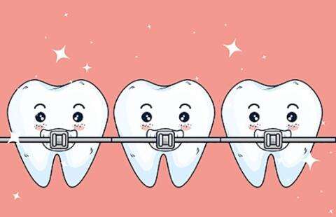 牙齿贴面有什么优势和缺点？